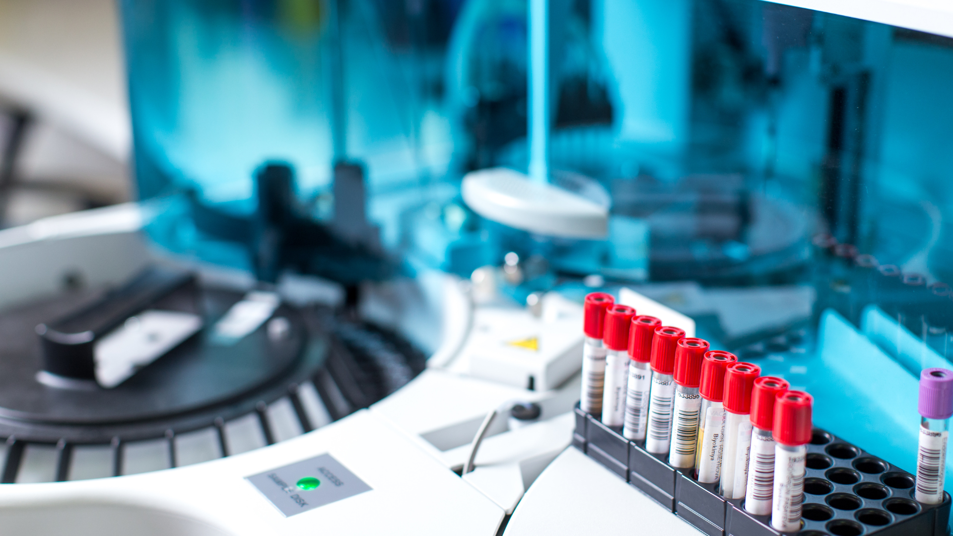 Diagnosi precoce di SLA: nuove speranze da un test del sangue
